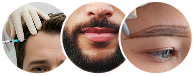 injertos
