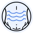 Abdominoplastía